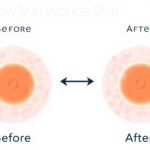 Illustration showing how retinol works on skin cells